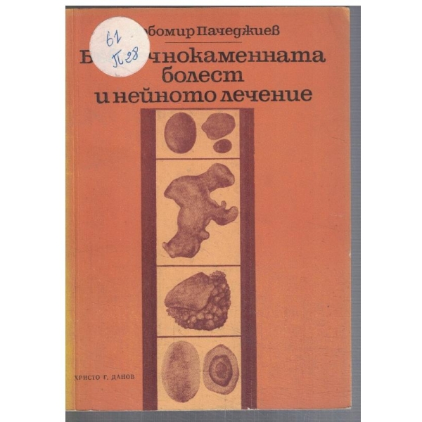 Бъбречно-каменната болест и нейното лечение
